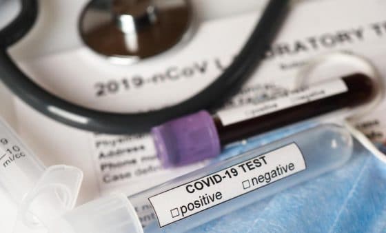 La OMS, IBM y Oracle verificarán datos sobre el coronavirus en una blockchain