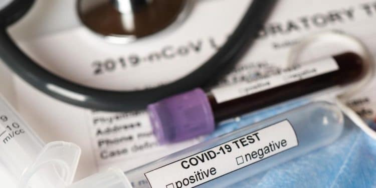 IBM-oracle-colaboran-iniciativa-coronavirus