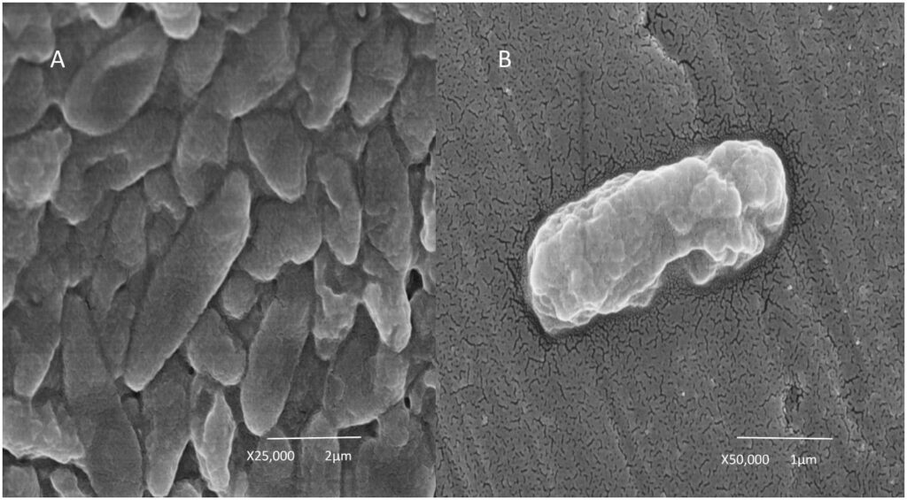 Foto microscópica de una bacteria Cupriavidus metallidurans